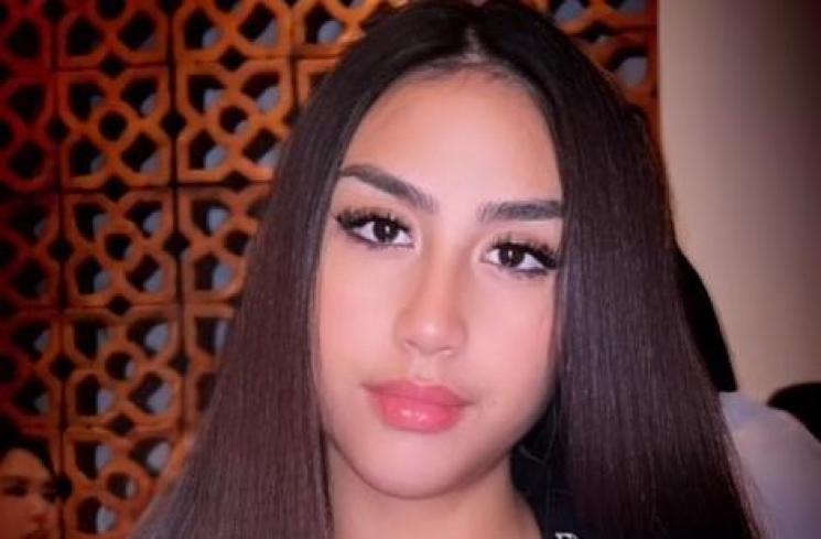 Potret terkini Khayra anak Gunawan. (Instagram/gunawan_sudrajat_real)