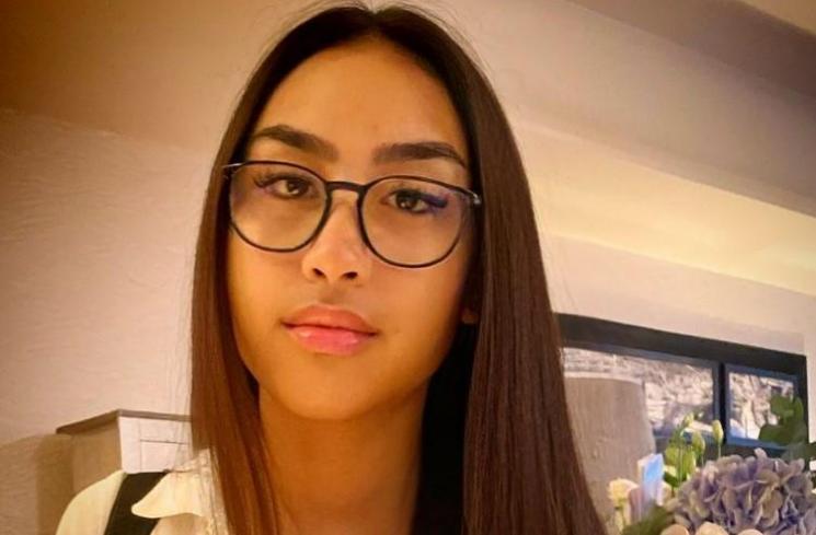 Potret terkini Khayra anak Gunawan. (Instagram/gunawan_sudrajat_real)