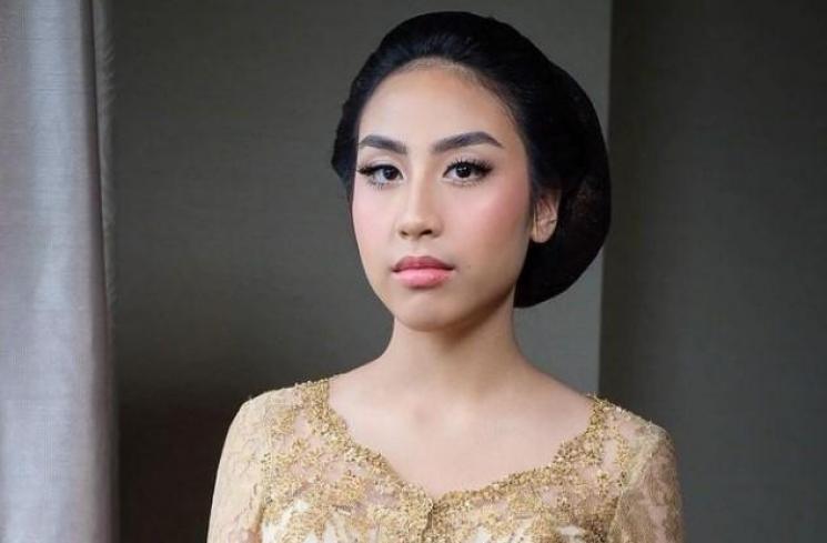 Potret terkini Khayra anak Gunawan. (Instagram/gunawan_sudrajat_real)