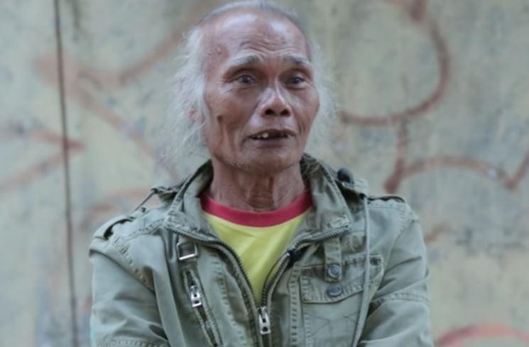 Potret Terbaru Zainal Abidin. (YouTube/TRANS7 OFFICIAL)