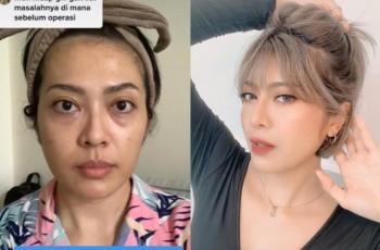 Glow Up Abis, Ini 10 Transformasi Yenny AFI yang Akui Lakukan Oplas Hidung