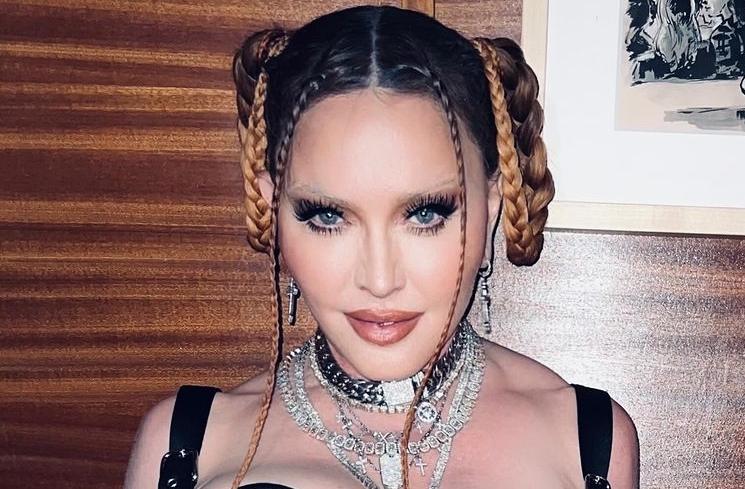 Artis Kecanduan Oplas (instagram/@madonna)