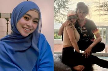 Dinda Hauw dan Lesti Dandan Tebal, Rambut Pacar Denise Chariesta Disorot