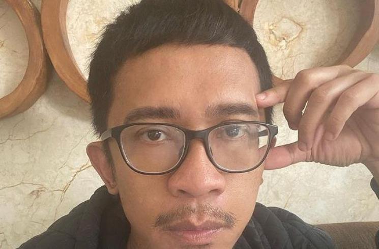 Potret Aming dengan Rambut Pendek. (Instagram/amingisback)