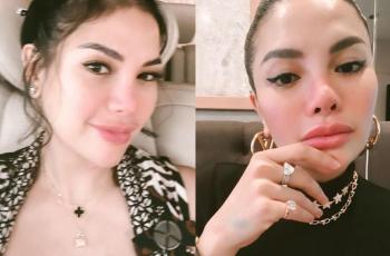 Nikita Mirzani Foto Selfie dari Dekat: Satu Gaya Nindy, Satu Gaya Agnez Mo