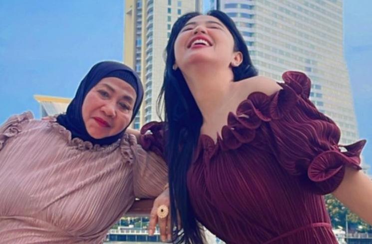 Potret Terbaru Wajah Dewi Perssik (instagram/@dewiperssik9)