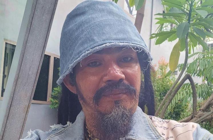 Artis Pria Operasi Vasektomi (Instagran/@limbadindonesia) 
