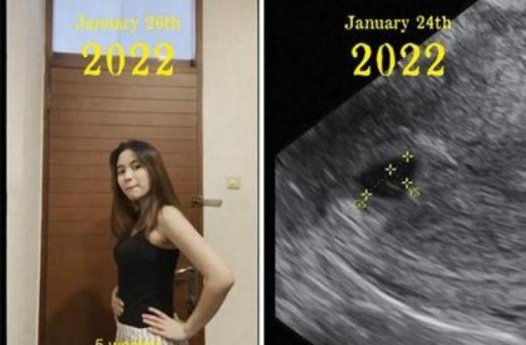 Potret Perjalanan Ashilla Zee Hamil. (Instagram/zhrtiaraashilla)