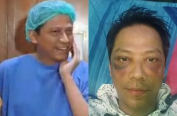 Doddy Sudrajat Pamer Wajah Usai Operasi, Netizen Ngakak: Kaya Habis Digebukin