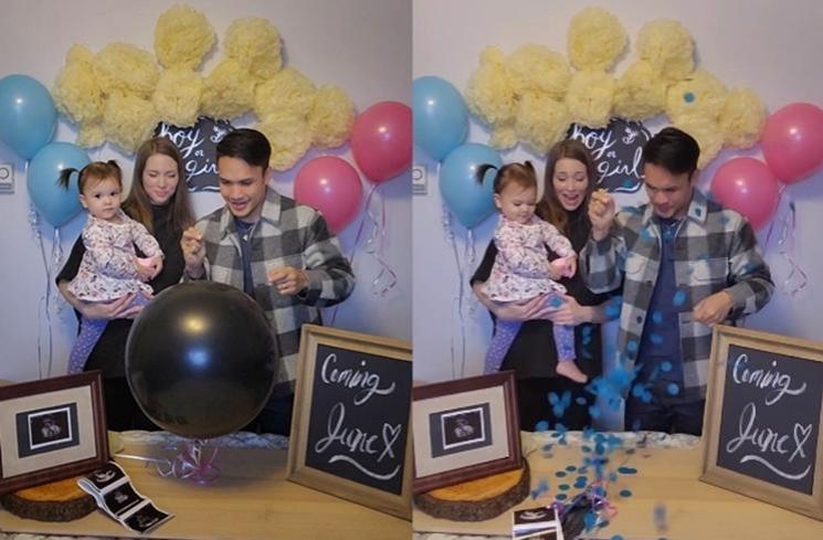 Perjalanan Kehamilan Istri Randy Pangalila (instagram/@randpunk)