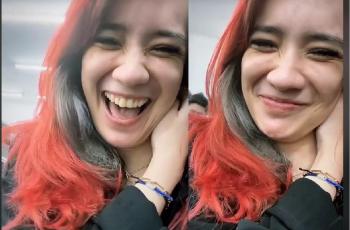 Lepas Hijab, Putri Anne Kini Pamer Rambut Merah Menyala: Tetap Ceria Walau Terluka
