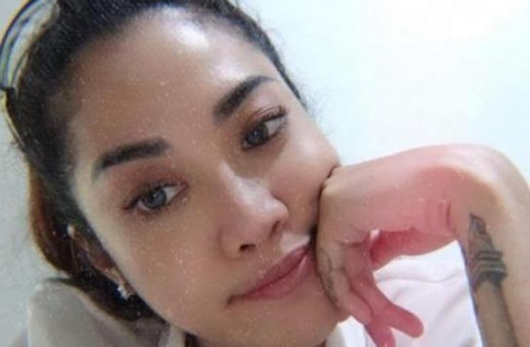 Artis Hapus Tato. (Instagram/_widikidiw_)