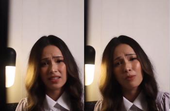 Lady Nayoan Beberkan Kondisinya usai Kecelakaannya Disebut Settingan, Perlihatkan Tangan Memar dan Bengkak