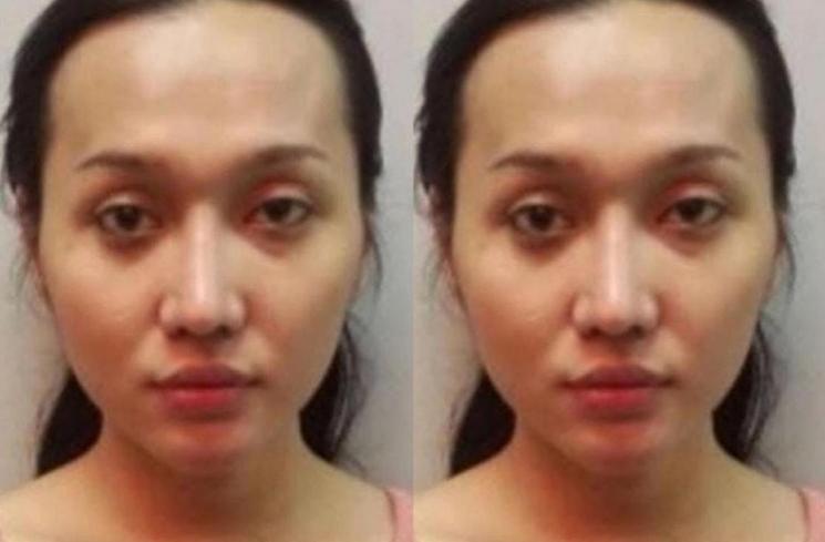Perbandingan Wajah Lucinta Luna Dulu dan Kini (instagram/@lambe_turah)