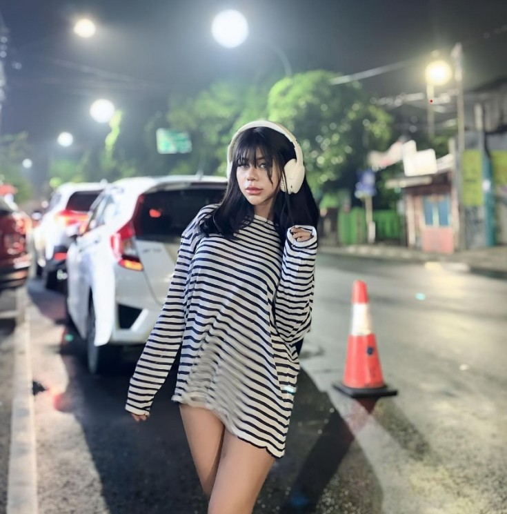 Potret terbaru Cimoy Montok setelah oplas. (Instagram/@cimoynuraini_wjy)