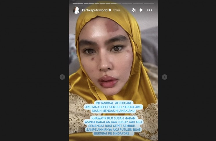 Kartika Putri. (Instagram/@kartikaputriworld)