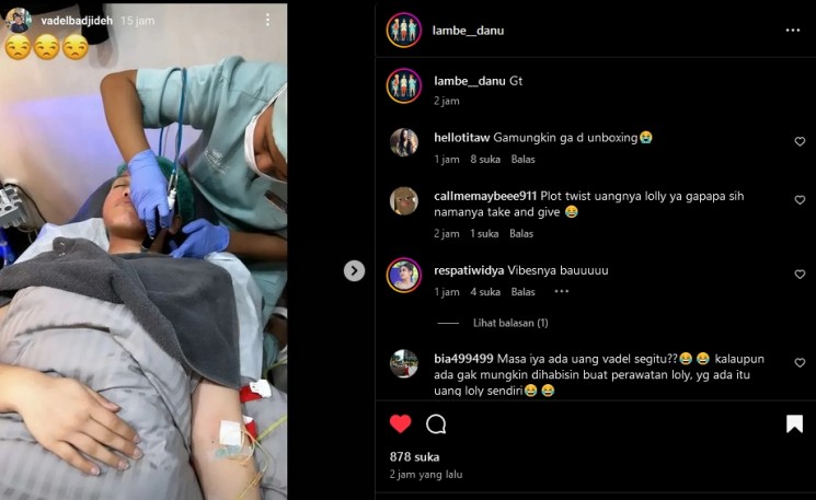 Lolly jalani perawatan wajah (instagram)