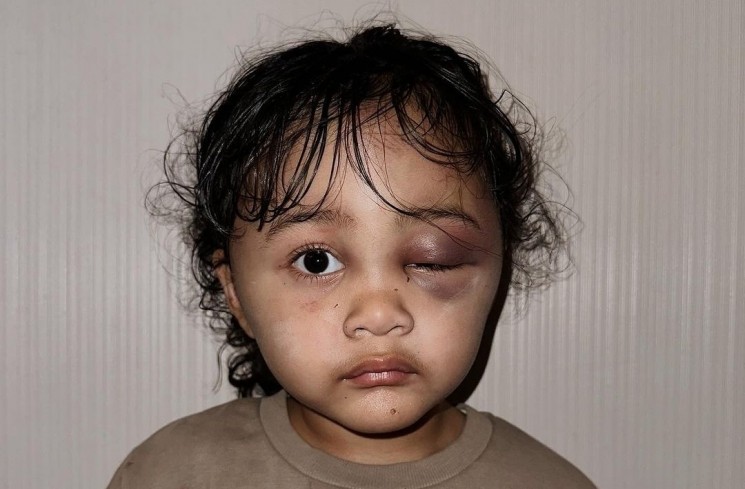 Anak Aghnia Punjabi menjadi korban penganiayaan pengasuhnya (Instagram/@emyaghnia)